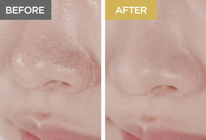 662a0613f02770-skin1004-madagascar-centella-cleansing-oil-ucinek.webp
